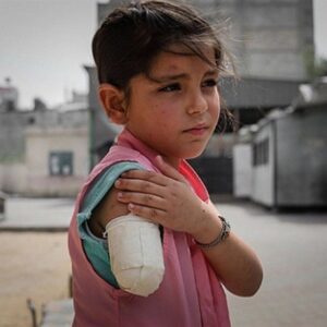 سازمان ملل: غزه وطن بزرگترین گروه از کودکان قطع عضو شده است