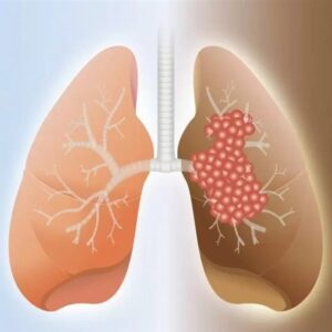 مهندسی معکوس پیچیده‌ترین داروی ریوی جهان توسط متخصصان ایرانی