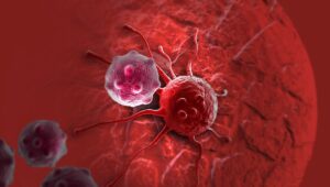 سرطان پستان در ایران رو به افزایش است