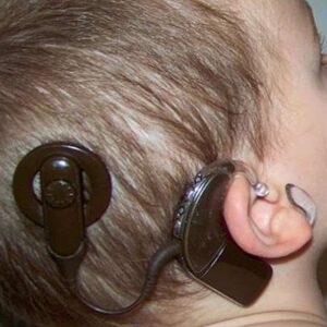 کاشت حلزون در بیمارستان الزهرای زاهدان؛ ۱۷۰ نفر صاحب شنوایی شدند