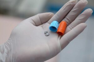 پرکردن دندان با آمالگام؛ از مزایا تا معایب آن