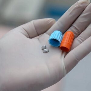 پرکردن دندان با آمالگام؛ از مزایا تا معایب آن