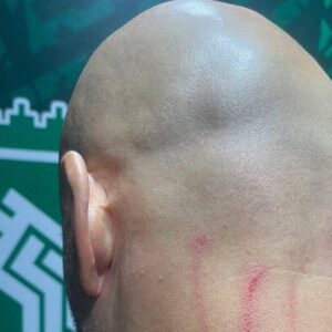 جراحت مربی دروازه‌بان‌های استقلال در پایان بازی با خیبر