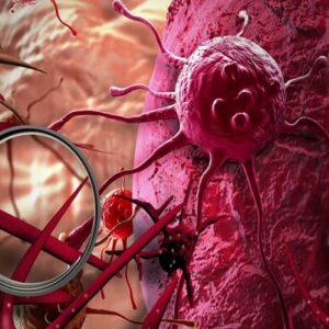 تشخیص زودهنگام سرطان پستان کلید نجات ۹۵ درصد بیماران