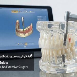 «ایمپلنت دیجیتال» و کاشت فوری دندان