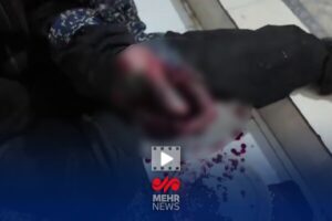 انفجار نارنجک دستی در دستان جوان ملاردی